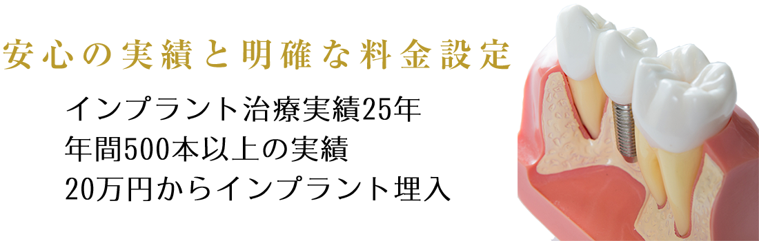 インプラント治療の解決・解説・支援専門サイト　もう悩まないインプラント治療